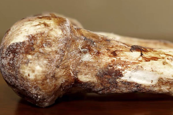 腎炎能吃松茸嗎 腎炎能吃松茸嗎