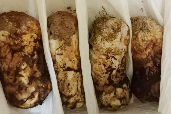 松茸是食用菌嗎